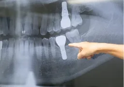 白金台の歯医者・矯正歯科「カズデンタルクリニック白金台」|一般歯科